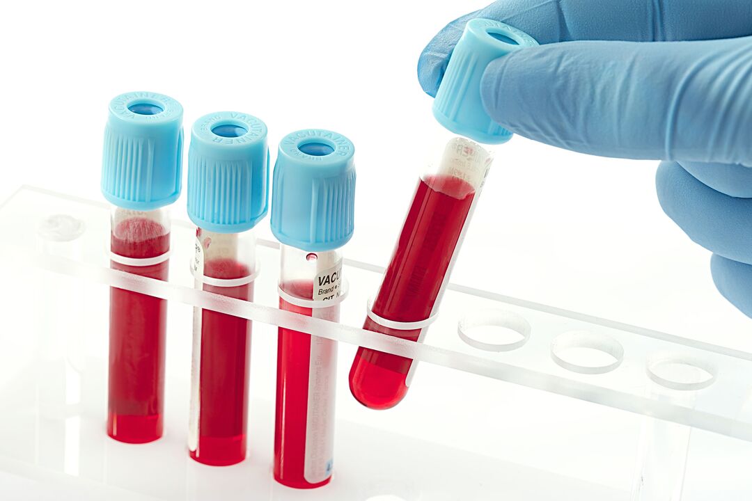 blodprøve for å diagnostisere humant papillomavirus