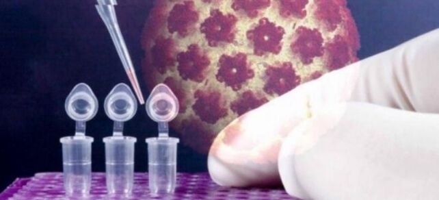 HPV-diagnostikk ved hjelp av digene-testen